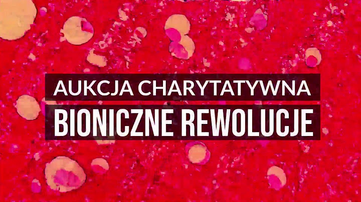 Aukcja Charytatywna "Bioniczne Rewolucje" -  już wkrótce!
