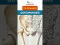 Prevent Osteoporosis Now | #BoneHealth #OsteoporosisPrevention #StayStrong