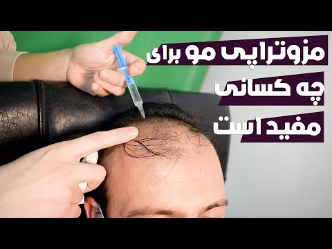 چرا مزوتراپی بهترین راه جلوگیری از ریزش مو است مزوتراپی مو برای چه کسانی مفید است