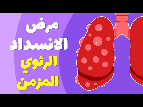   علاج مرض الانسداد الرئوي المزمن