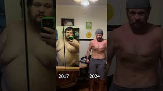 How I Look In 2024 After 2 Skin Removal Surgeries And 290 Lbs Lost.