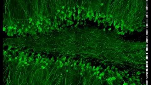 Mouse Hippocampus in 3D