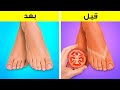 حيل العناية بالقدمين 🦶👣 حيل ذكية للحفاظ على قدميك ناعمة وجميلة