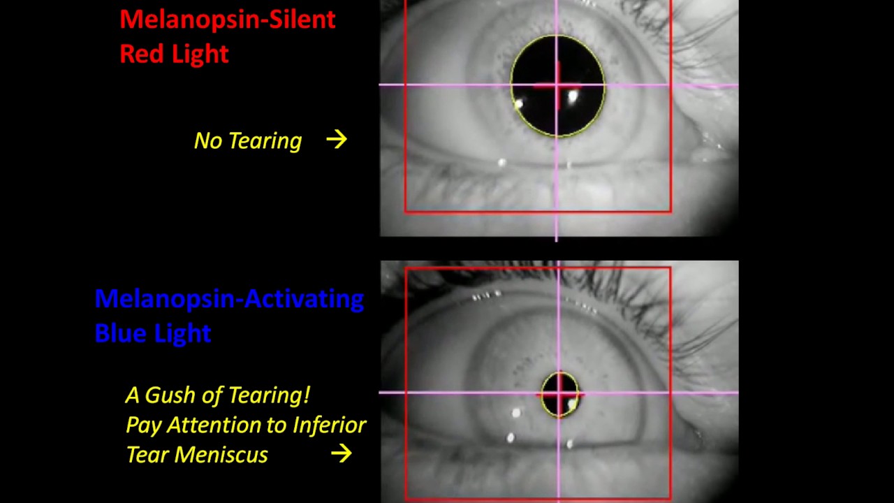 Light-induced Tearing and Post-illumination Pupil Response - YouTube