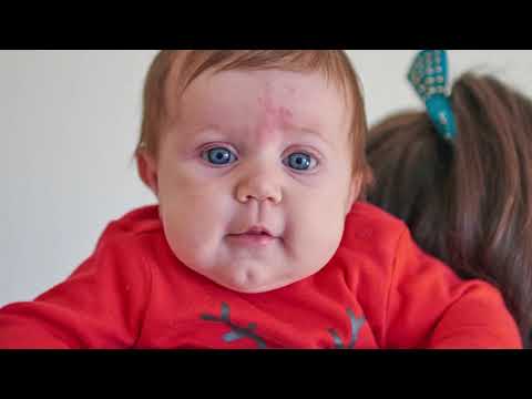Video: Znaci Disbioze Kod Novorođenčadi