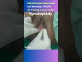 Best Hymenoplasty surgery in Ranchi | Result of Hymenoplasty surgery| Hymen repair surgery in Ranchi