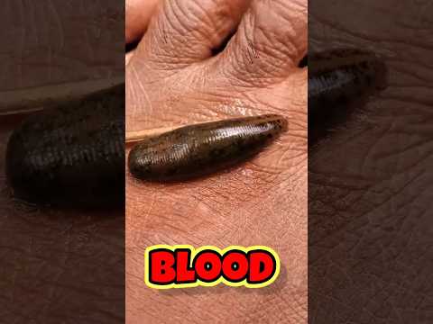 Leech 😭😭😭😭 |