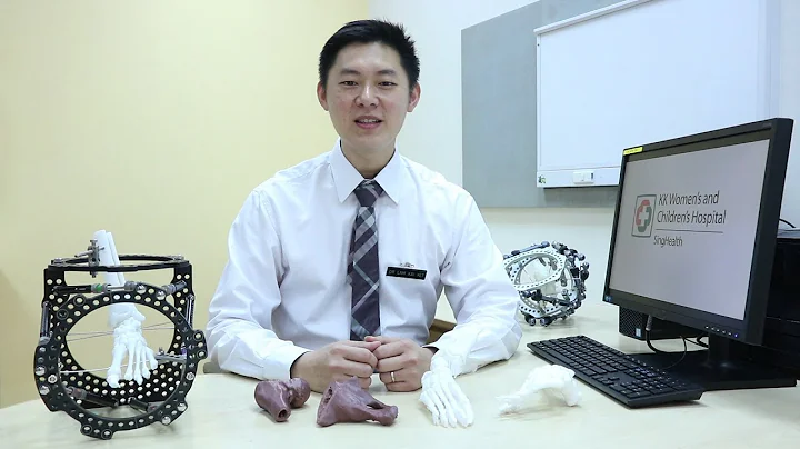 3D Printing at KKH – Helping children with limb deformities to walk again