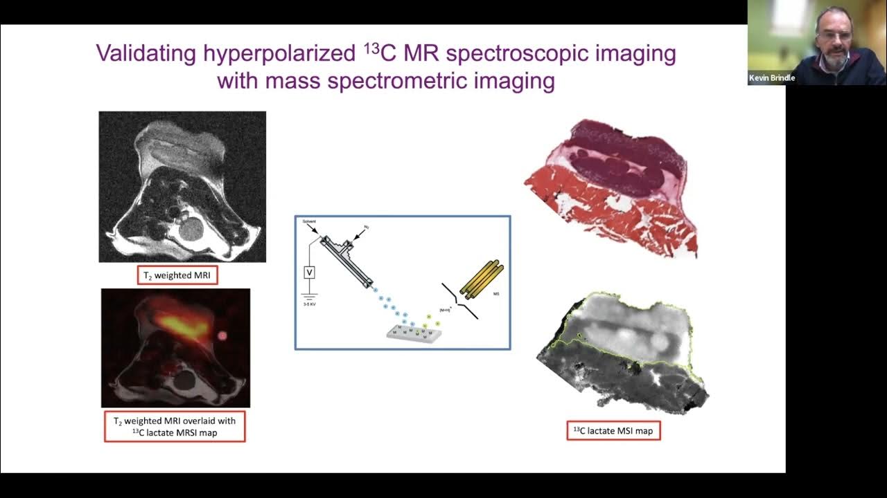 Stanford Radiology CEDSS (Fall) 2022, Brindle Imaging Tumor
