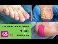 Стержневая мозоль удаление 🌸 Грибок ногтей 🌸 Трещины 🌸 Очень много работы 🌸 Педикюр 🌸 Ирина Брилёва