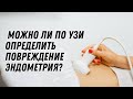 Можно ли по УЗИ определить повреждение эндометрия #doctorberezovska #olenaberezovska #эндометрий