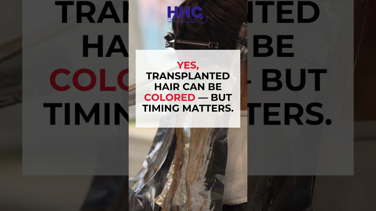 Can Transplanted Hair Be Colored? 💇‍♂️ | Hair Coloring After Transplant Explained