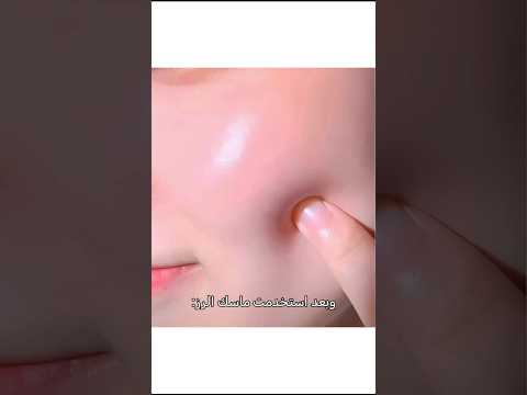 بشرتي قبل ما أستخدم ماسك الرز