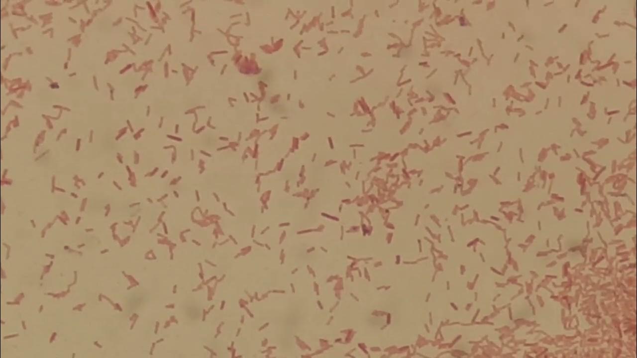 Moraganella in Gram Staining YouTube