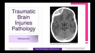 Traumatic Brain Injuries Pathology | Comprehensive Guide & Step 1 Review | Pathology Step 1 USMLE