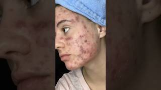 Красивая и здоровая кожа благодаря этому гаджету Артикул на Wildberries 412327844