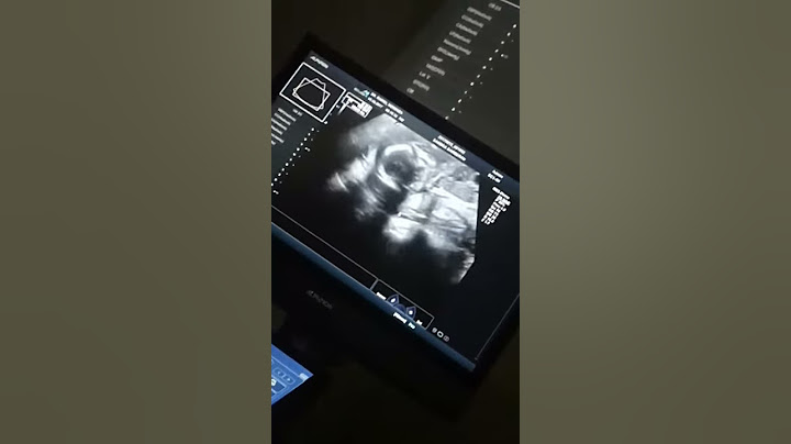 mi bebe de 19 semana es niña