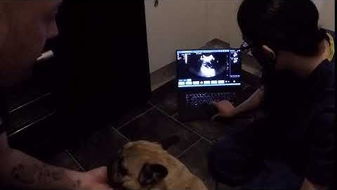 Scan footage on the new ScanX ultrasound machine