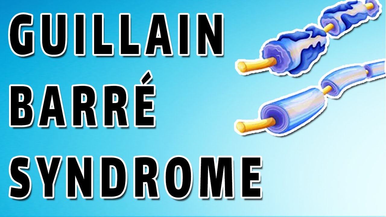 Guillain Barre Syndrome Causes Symptoms And Treatment Youtube