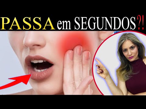 Vídeo: Óleo De Cravo Para Dor De Dente: Isso Funciona?