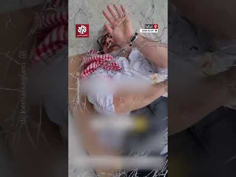 أنا فقط طبيب أطفال مشهد تمثيلي أمام متحف تركي يجسد معاناة الطبيب الفلسطيني حسام أبو صفية 