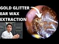 Gold Glitter Extracted From Childs Ear (Nociception and Pain)