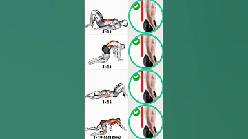 Sway Back Posture Correction Exercises Workout Posturecorrection 