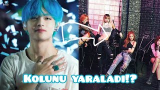 V Boombayah Dansı Yaparken Kolunu Yaraladı?