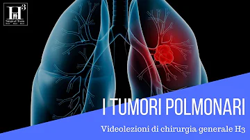 Quali sono i sintomi del versamento pleurico?