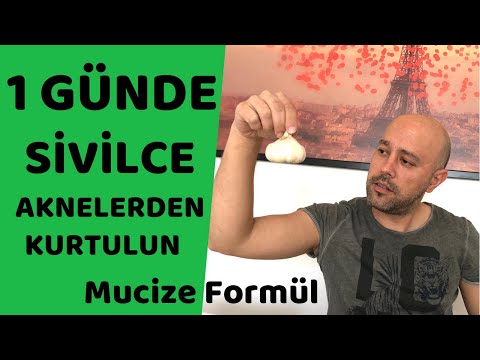 Sivilce ve Aknelerden 1 Günde Kurtulun !! Sivilce ve Aknelere Bitkisel Kesin Çözüm !