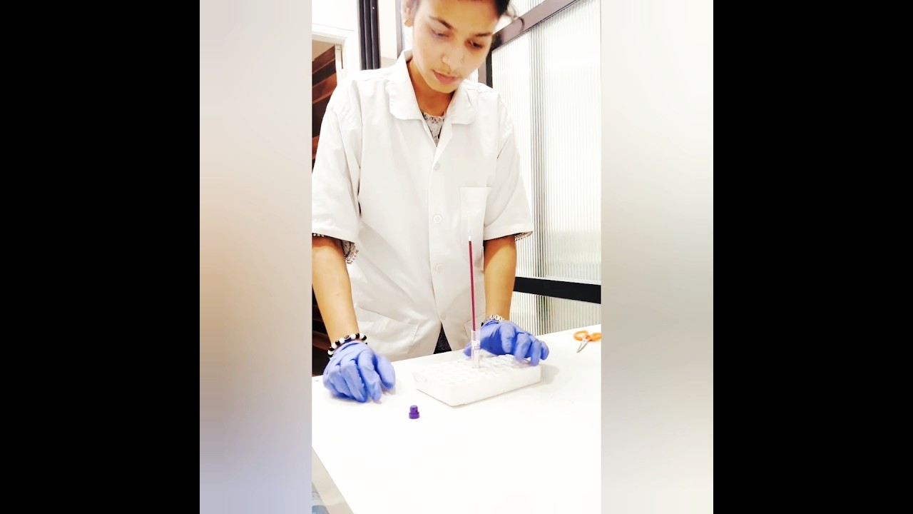 ESR ( westergren method) # shorts