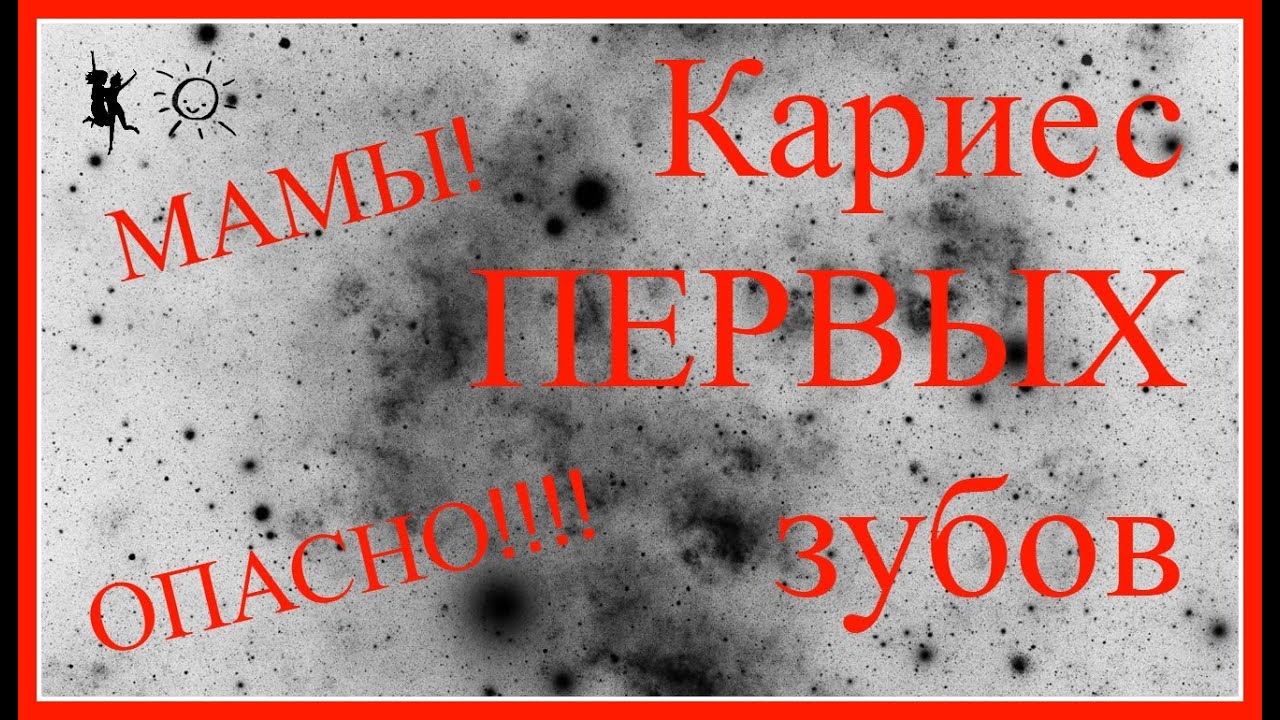 Мамы! ОПАСНО, кариес ПЕРВЫХ зубов!