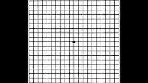 Grid for Macular Degeneration