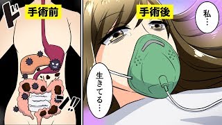 【漫画】便が全く出なくなり腸管破裂したらどうなるのか？【マンガ動画】