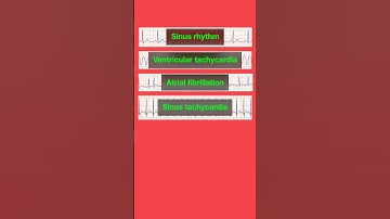 ECG Rhythms Quiz #shorts