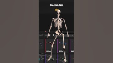 10000 Spectrum case opening!