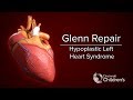 Medical Animation: Glenn Operation | Cincinnati Children's