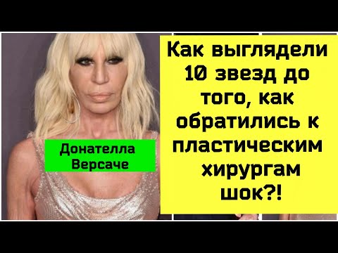 КАК выглядели 10 ЗВЕЗД ДО ТОГО, КАК СДЕЛАЛИ ПЛАСТИКУ?! ШОК ФОТО!