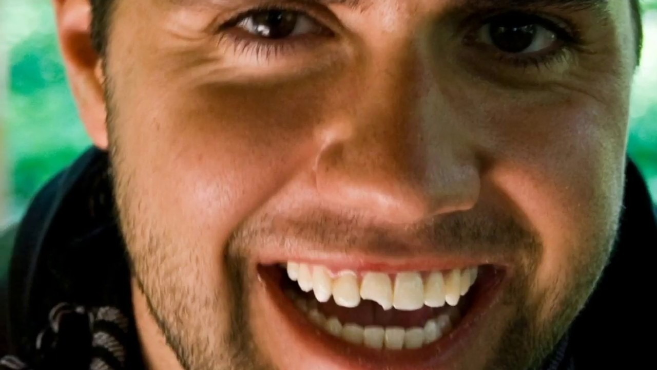 Veneers Quote Bonita Springs Cosmetic Dentistry YouTube