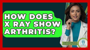 How Does X Ray Show Arthritis? - Orthopedic Support Network
