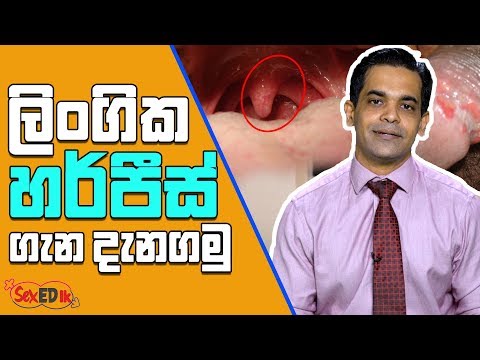 ලිංගික හර්පීස් ගැන දැනගමු...