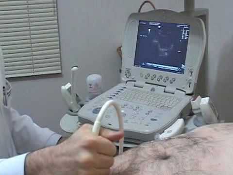 usg prostata via abdominal