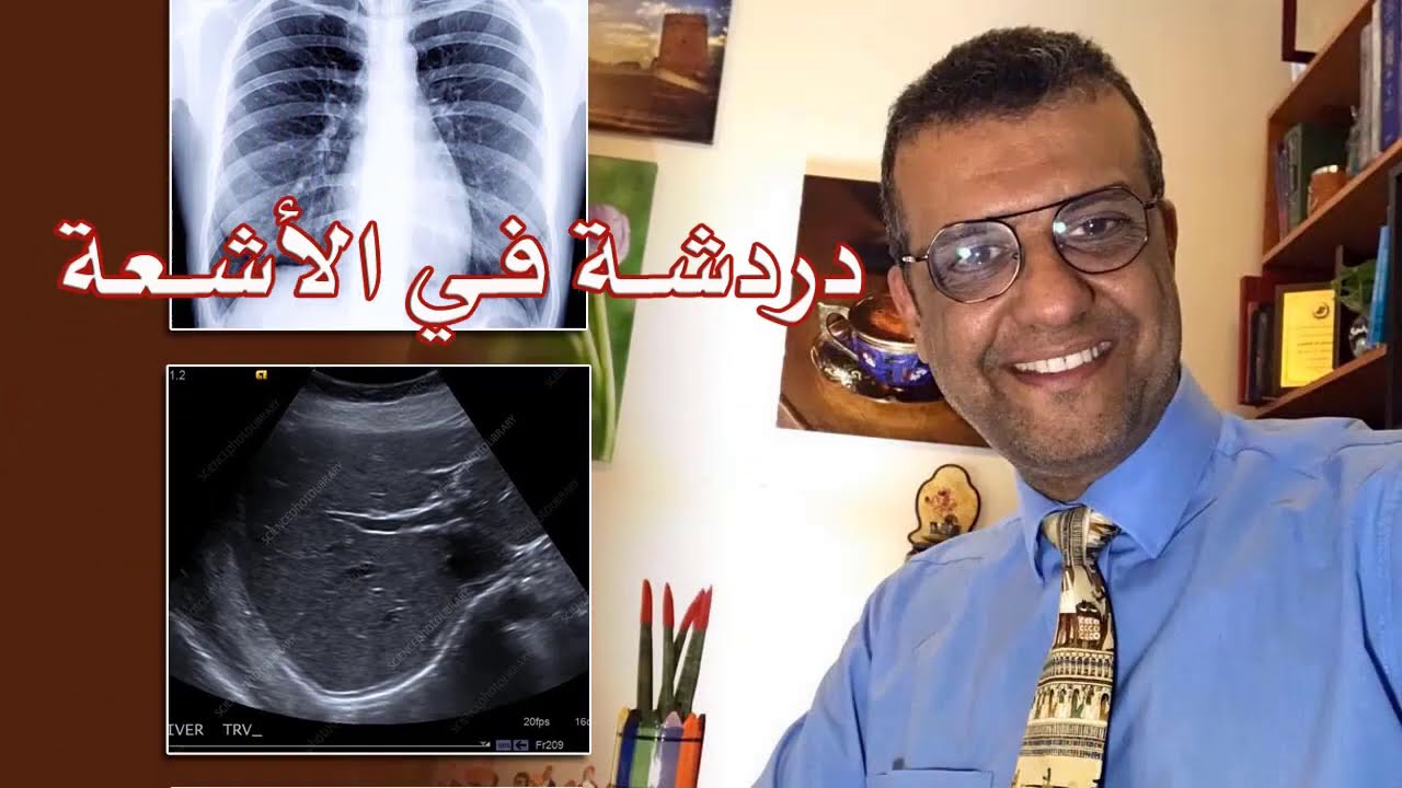 دردشة فى الأشعة 8 - misplaced lines and tubes in chest - د. أحمد رفاعي