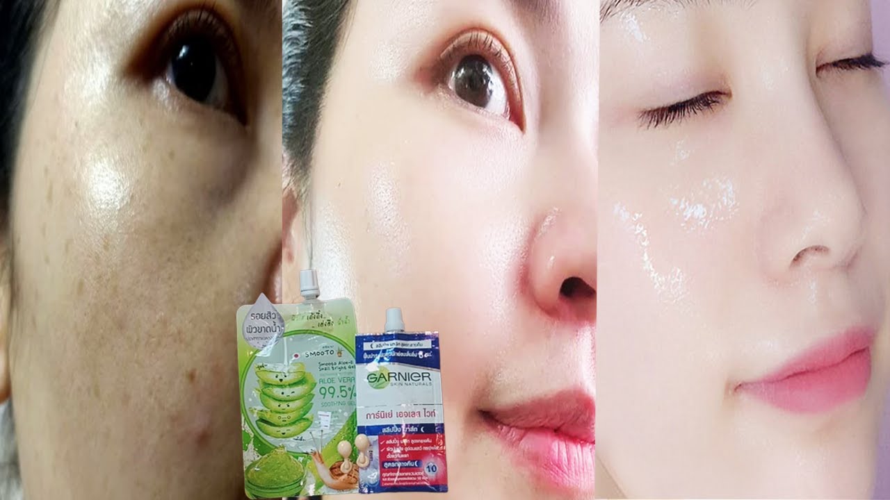 Get Clear Glowing Skin, Remove Large Poresមុខសសៃក្រហម ជាំ អាចម៌រុយ