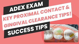 ADEX Exam Prep: Key Proximal Contact & Gingival Clearance Tips!