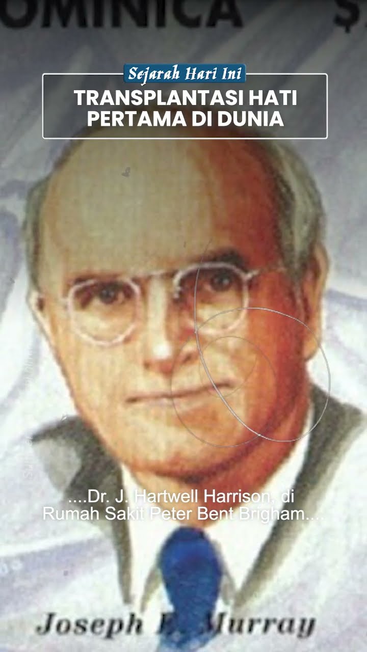 Transplantasi Hati Pertama di Dunia: Terobosan Medis oleh Dr Murray dan Harrison di Boston