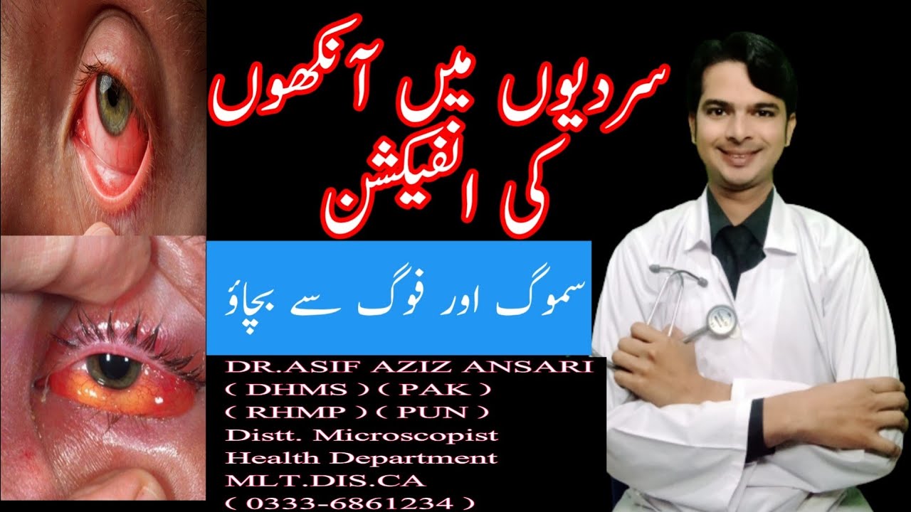 Eyes Infection in Winter Treatment with Homeopathic Medicine in Urdu