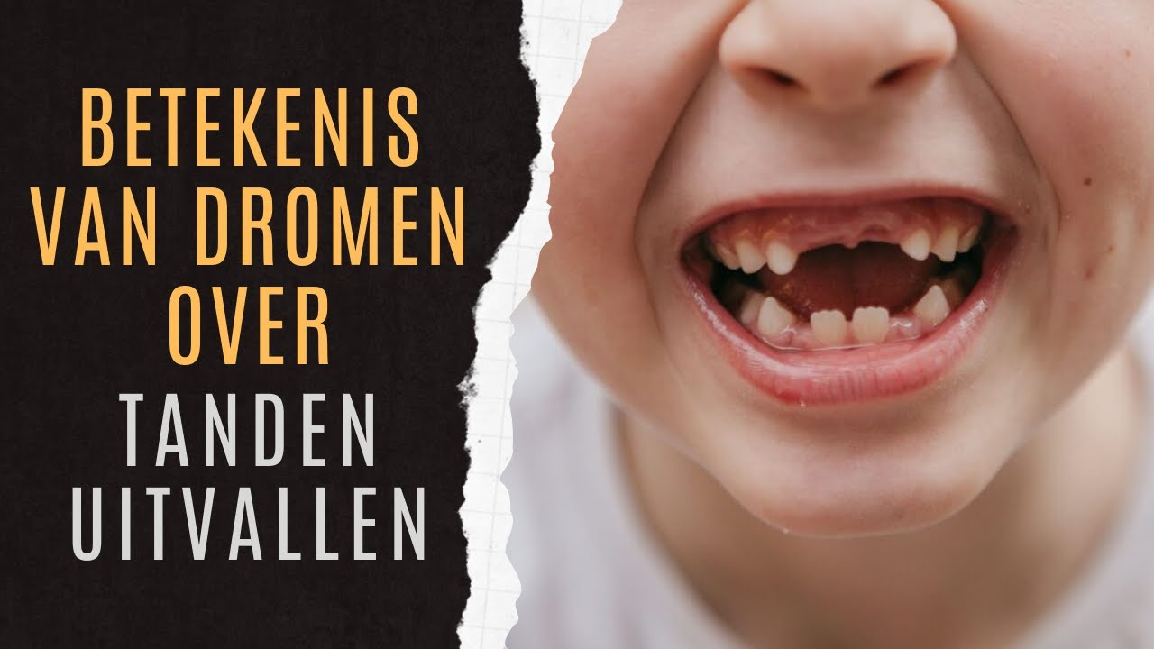 Tanden Uitvallen Betekenis | Tanden Uitvallen Droomuitleg | Tanden