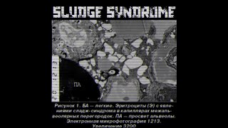 Sludge Syndrome: A Sludge/Hardcore Doom Metal Compilation