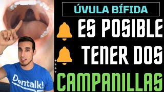 Tiene DOS CAMPANILLAS o ÚVULAS 🔔🔔 ¿Cómo es posible? - Úvula bífida